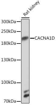 Western blot analysis of lysates from Rat kidney, using CACNA1D Rabbit polyclonal antibody (STJ11102779) at 1:1000 dilution. Secondary antibody: HRP Goat Anti-Rabbit IgG (H+L) (STJS000856) at 1:10000 dilution. Lysates/proteins: 25 Mu g per lane. Blocking buffer: 3% nonfat dry milk in TBST. Detection: ECL Basic Kit. Exposure time: 90s.